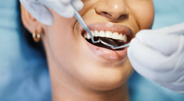 Best Urgent Care for Lost Fillings or Crowns in Dodgeville, WI