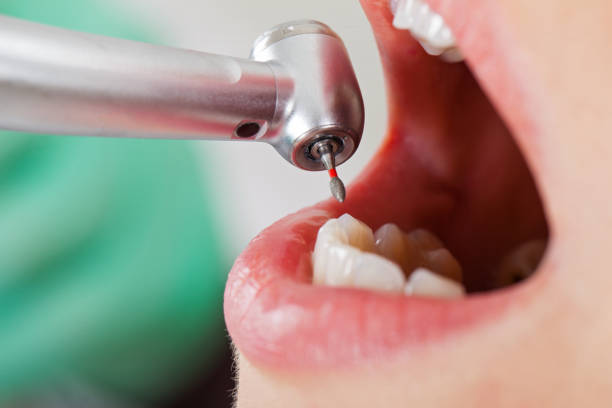 Best Emergency Treatment for Dental Infections or Abscesses in Dodgeville, WI